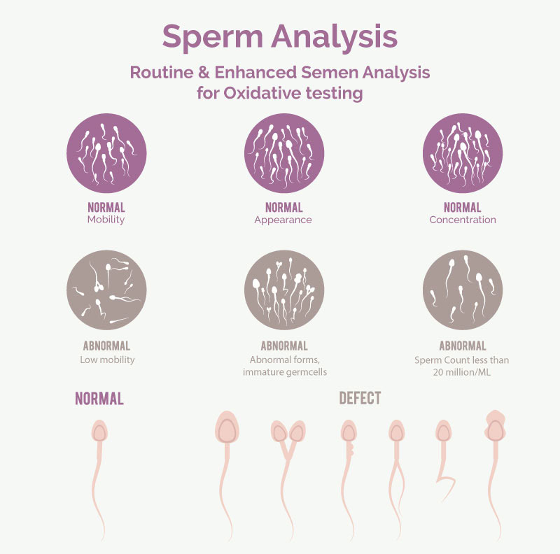 SPERM ANALYSIS